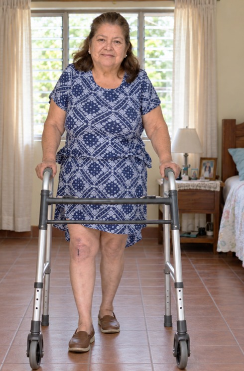 Leticia Cleotilde Cruz de pie con su andador después de sus reemplazos totales bilaterales de rodilla.